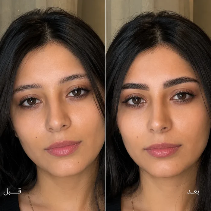 عکس قبل و بعد کرم ابرو تراست