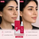 عکس قبل و بعد سرم روشن کننده تراست