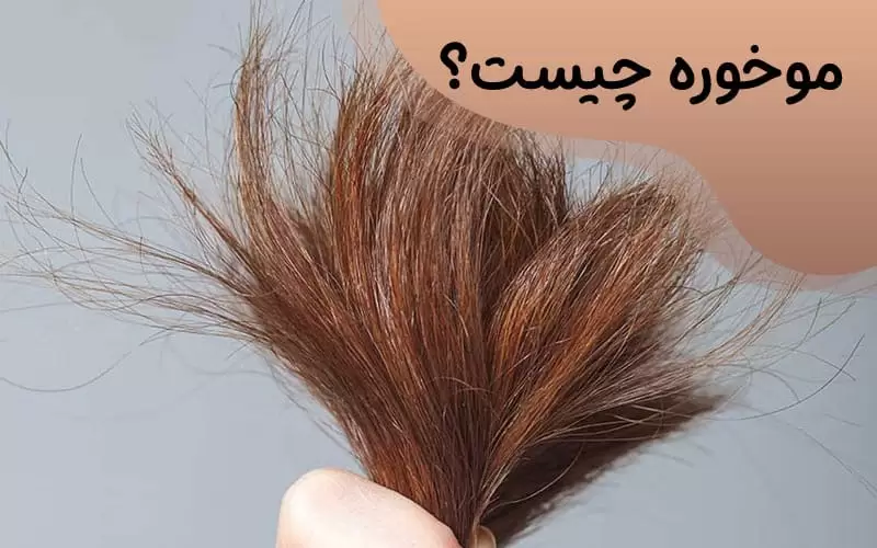 درمام موخوه