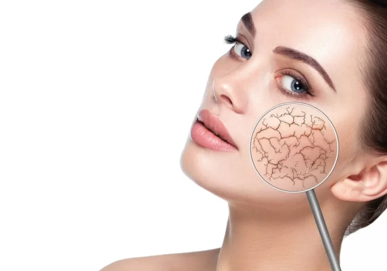 روتین مراقبت از پوست خشک تراست: راهی برای داشتن پوستی نرم، مرطوب و سالم