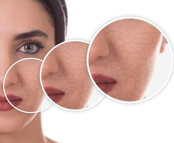 روتین مناسب پوست خشک تراست: راهنمای جامع با معرفی محصولات مناسب