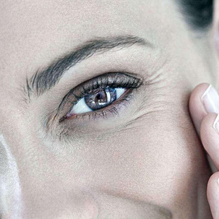 درمان چروک دور چشم