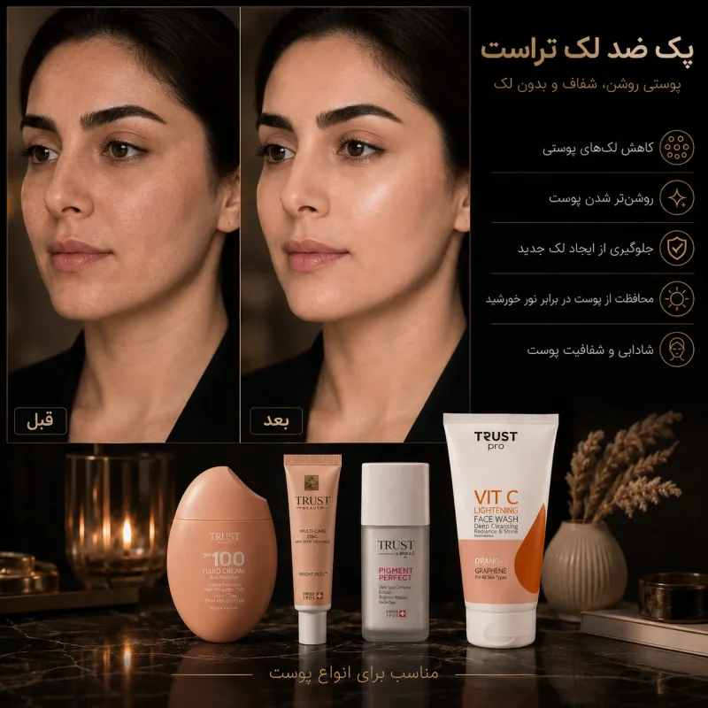 پک ضد لک تراست - Image 2
