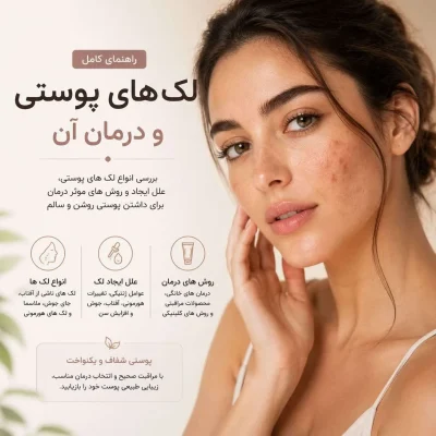 راهنمای کامل رفع لک و تیرگی پوست